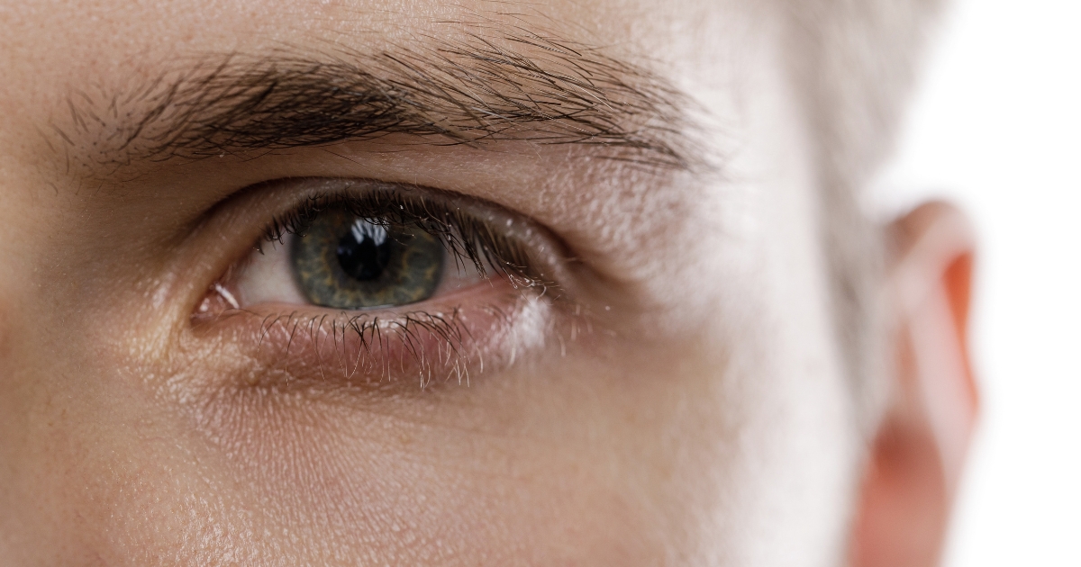 how do i get my eyes to stop being watery